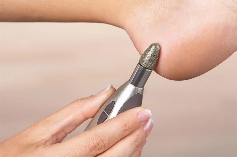 BEURER MP 60 3 BEURER MP 60 – Image 3