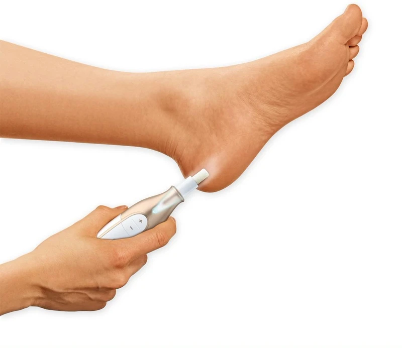 BEURER MP 64 2 BEURER MP 64 – Image 2