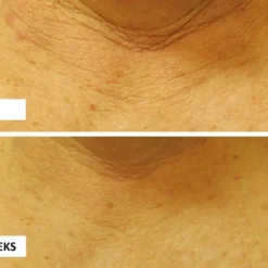 Perricone MD Cold Plasma Plus+ Neck & Chest -Teint Lisse Soldes Magasin perricone md cold plasma plus neck chest creme raffermissante cou et decollete spf 25 3